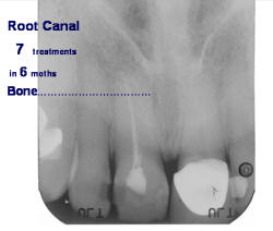 After OEC Therapy - Figure 2