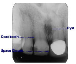 Before OEC Therapy - Figure 1